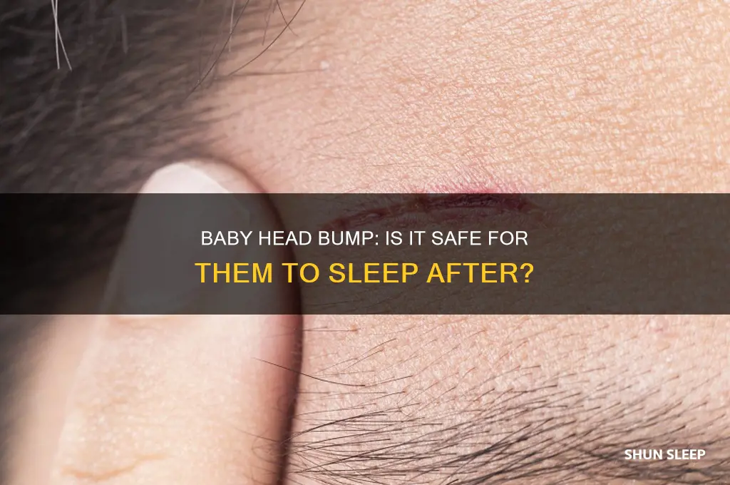 can my baby sleep after bumping head