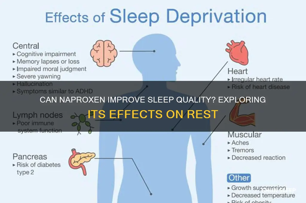 can naproxen help me sleep