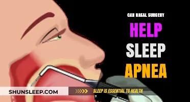Nasal Surgery for Sleep Apnea: Effective Treatment or Myth?