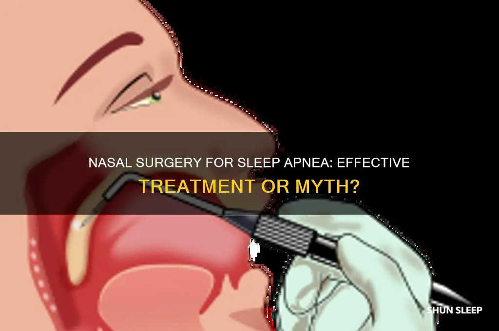 can nasal surgery help sleep apnea