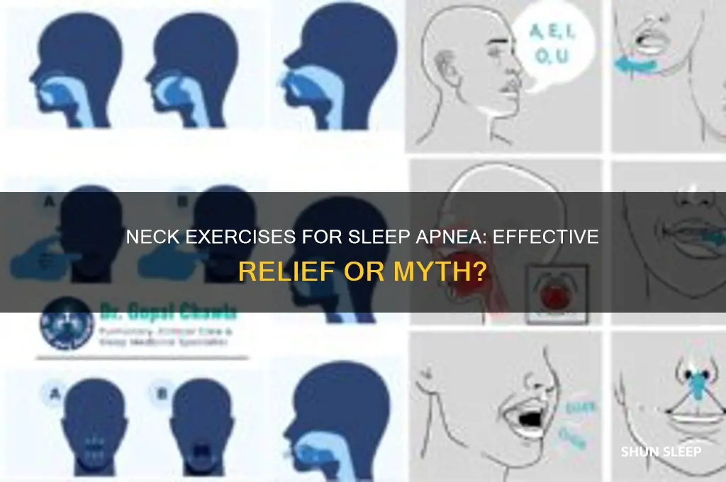 can neck exercises help sleep apnea