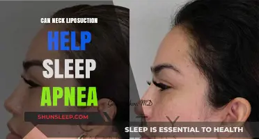 Neck Liposuction and Sleep Apnea: Exploring Potential Benefits and Risks
