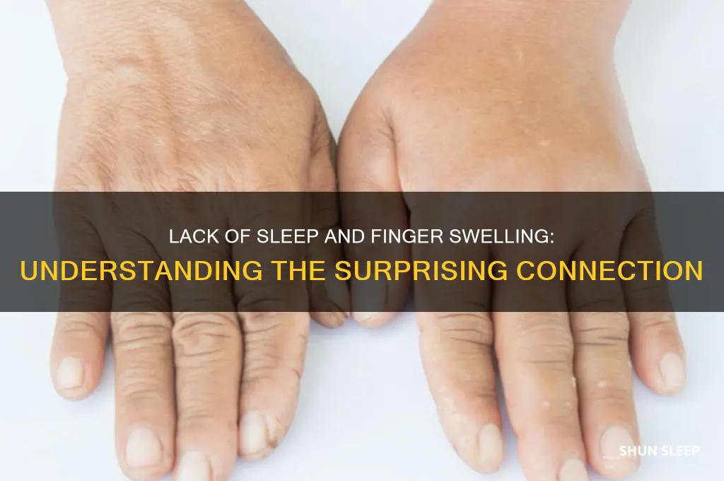can not get enuff sleep cause swelling in fingers