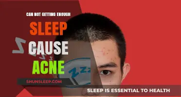 Lack of Sleep and Acne: Uncovering the Surprising Skin Connection