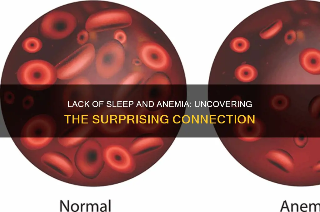 can not getting enough sleep cause anemia
