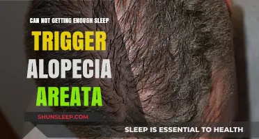 Sleep Deprivation and Hair Loss: Unraveling Alopecia Areata Triggers