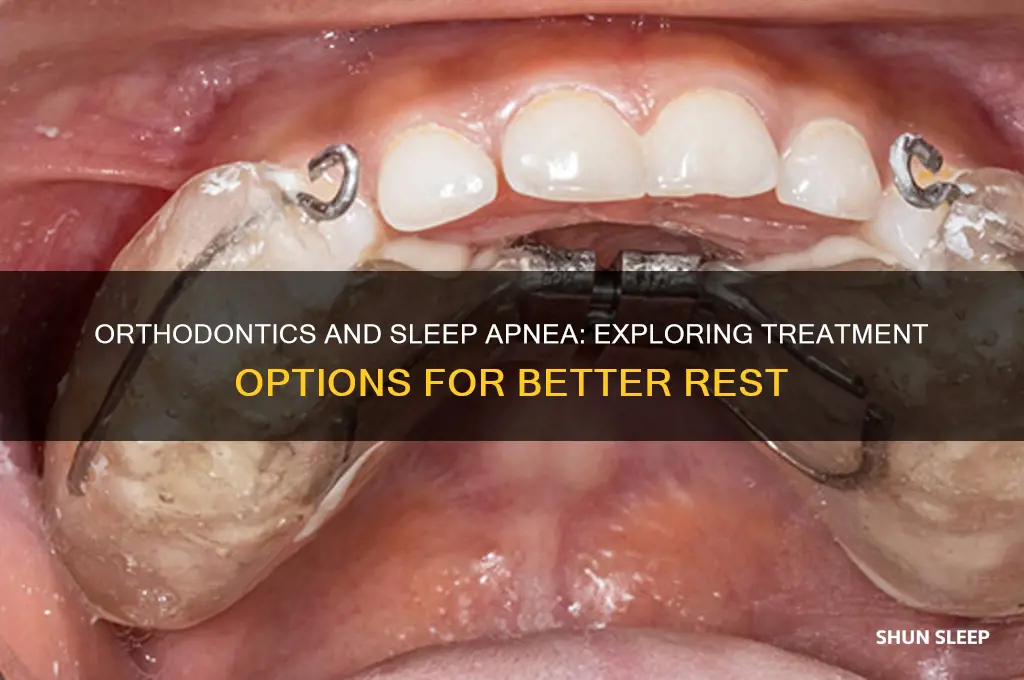 can orthodontics help sleep apnea