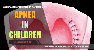 Adenoidectomy and Central Sleep Apnea in Children: Exploring the Connection