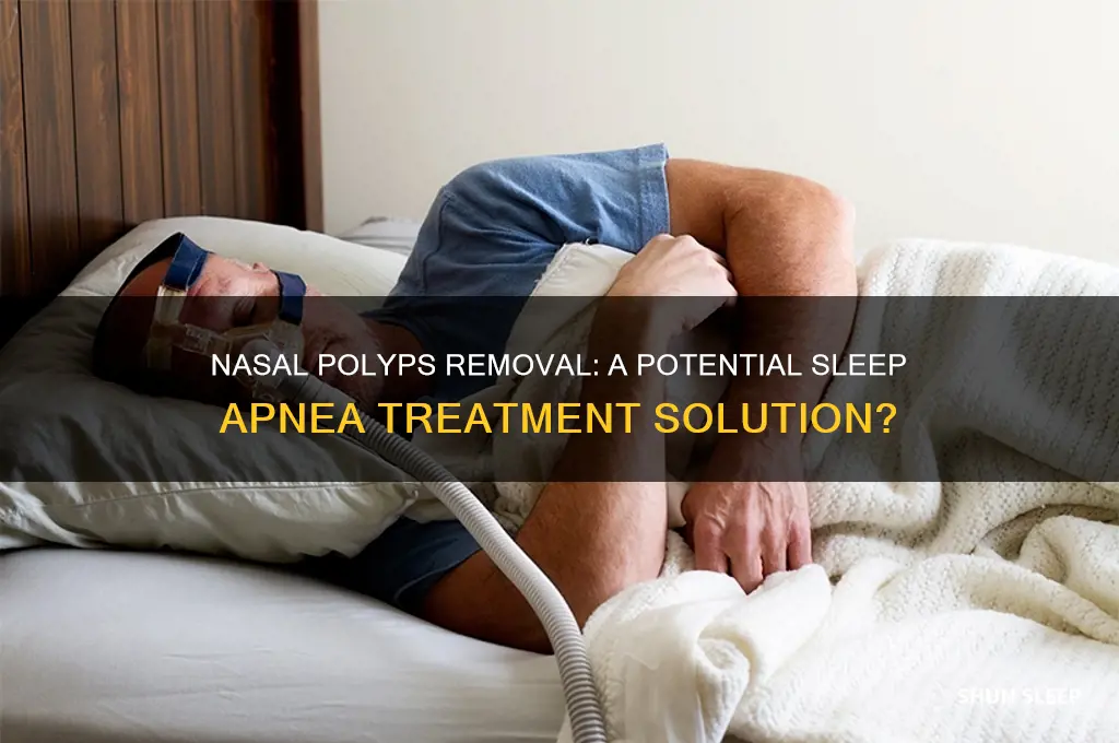 can removing nasal polyps help with sleep apnea