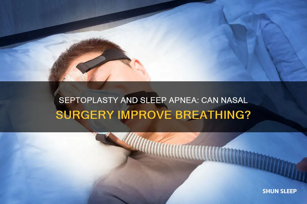 can septoplasty help sleep apnea