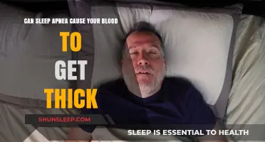 Sleep Apnea and Blood Viscosity: Unraveling the Connection to Thicker Blood