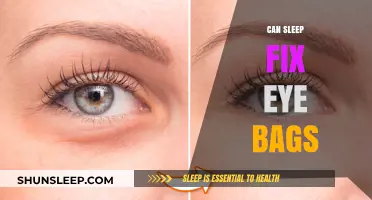 Sleep: The Ultimate Solution to Eye Bags