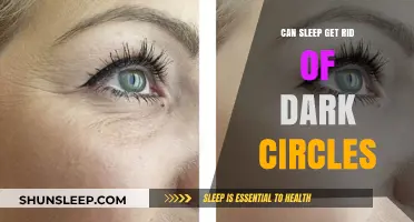 Can Quality Sleep Really Banish Dark Circles? Find Out Here