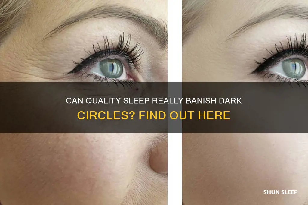 can sleep get rid of dark circles