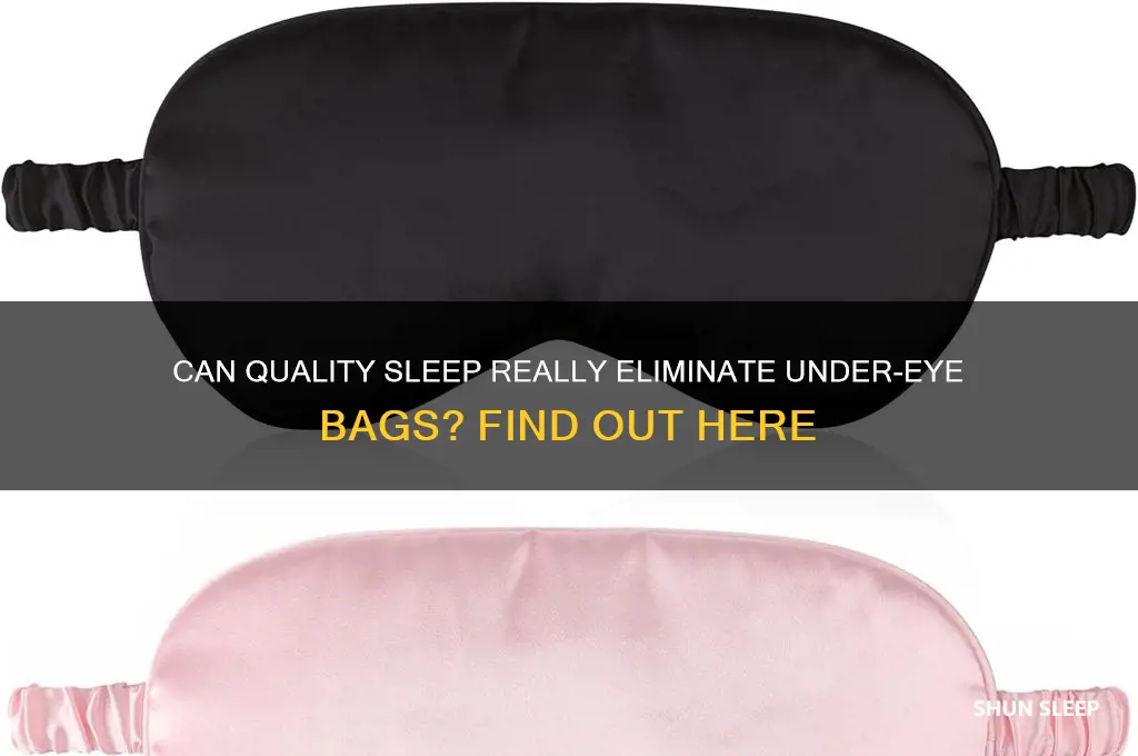 can sleep get rid of eye bags