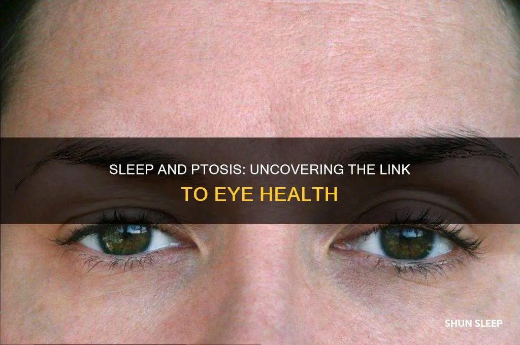 can sleep help ptosis