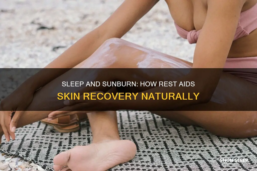 can sleep help sunburn