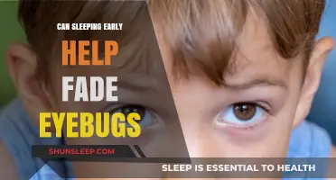 Early Bedtime: The Secret to Reducing Eye Bags and Dark Circles?