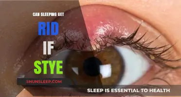 Can Quality Sleep Help Heal and Prevent Styes Naturally?