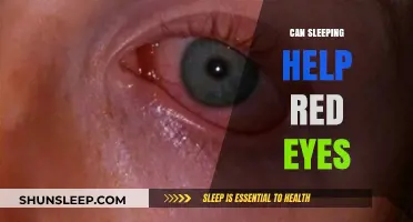 Sleep's Role in Soothing Red Eyes: A Natural Remedy Explored