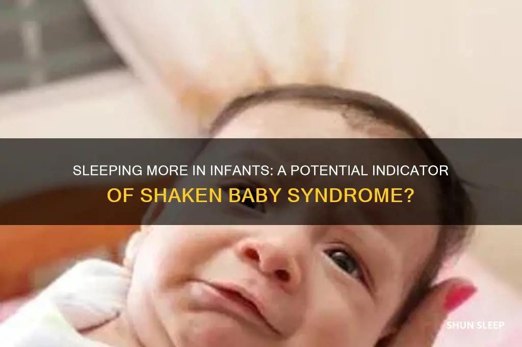 can sleeping more be a sign of shaken baby syndrome
