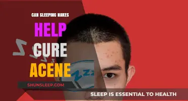 Sleeping Naked: A Natural Acne Remedy or Just a Myth?