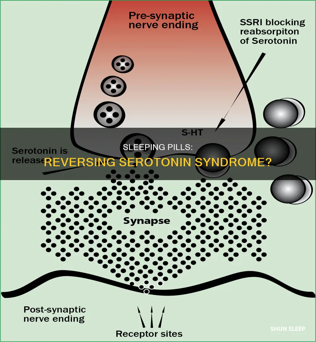 can sleeping pills reverse serotonin syndrome