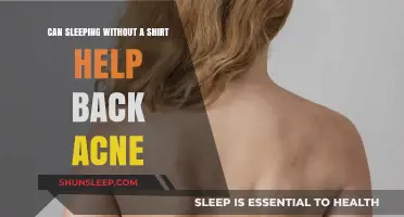 Sleeping Shirtless: A Simple Solution for Clearing Back Acne?