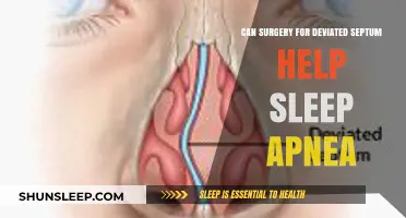 Deviated Septum Surgery: A Potential Sleep Apnea Solution?