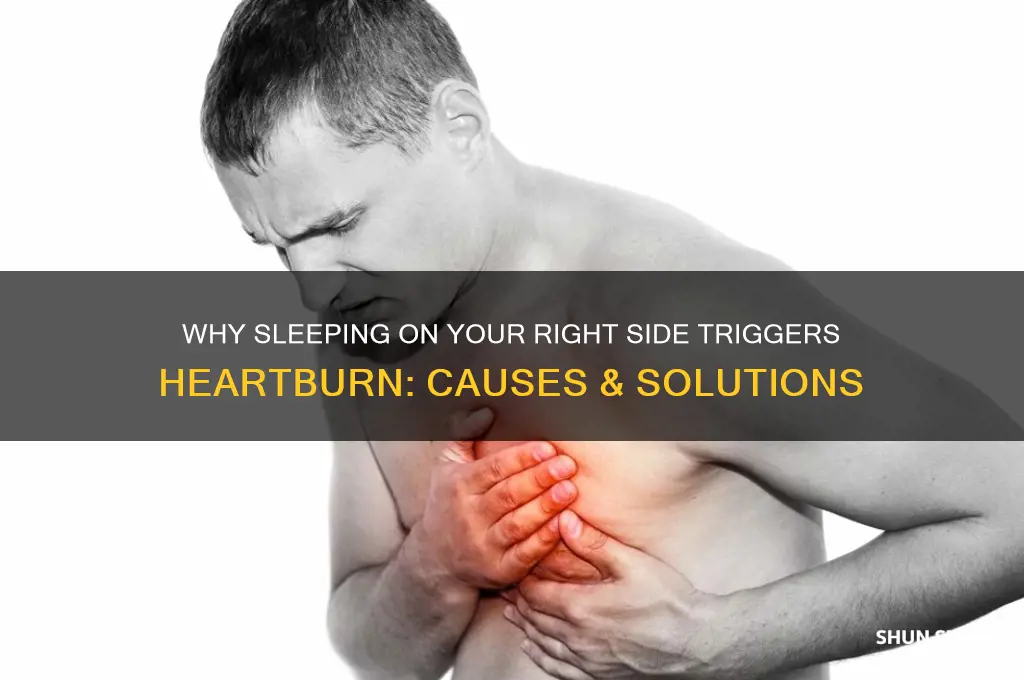 can t sleep on right side get heartburn