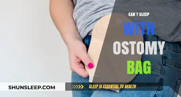 Ostomy Bag: A Sleepless Night's Companion