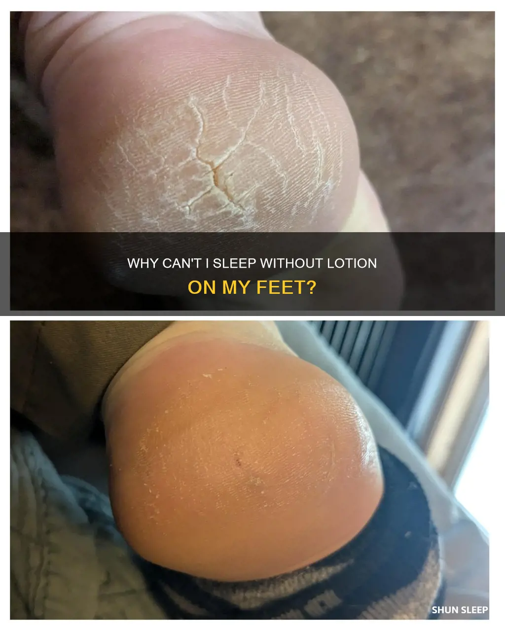 can t sleep without lotion on feet