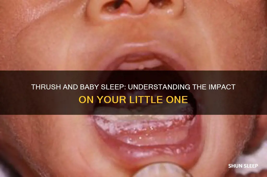can thrush affect a baby