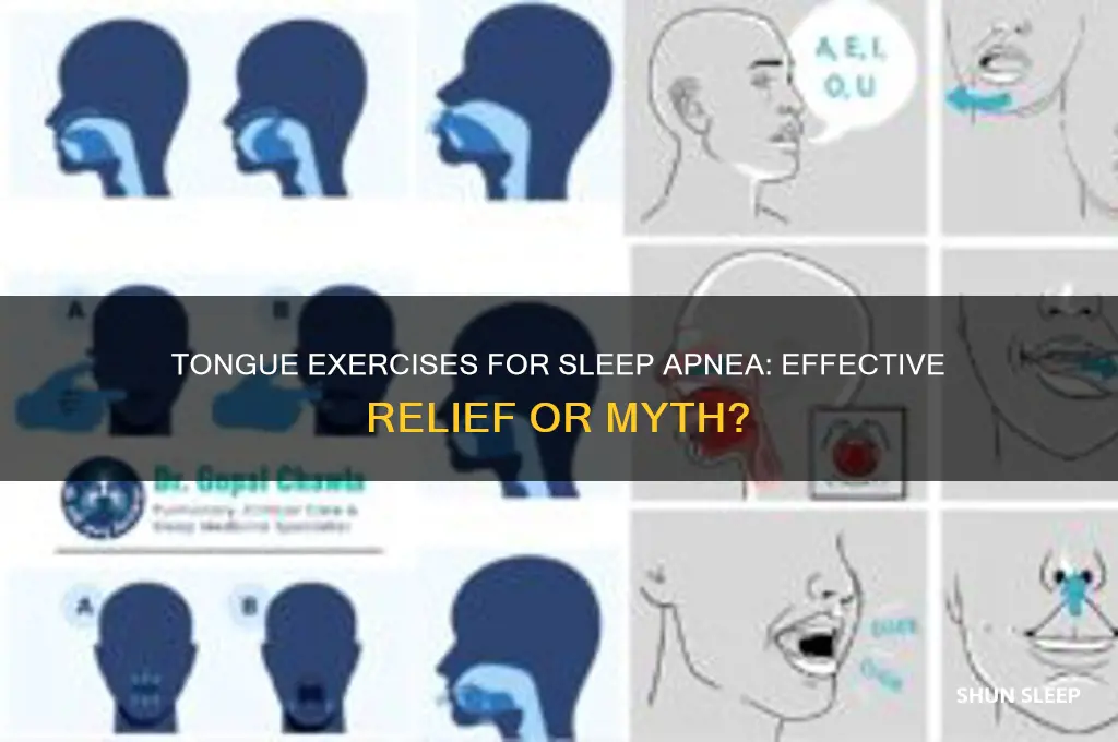 can tongue exercises help sleep apnea