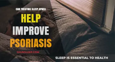 Treating Sleep Apnea: A Potential Key to Improving Psoriasis Symptoms