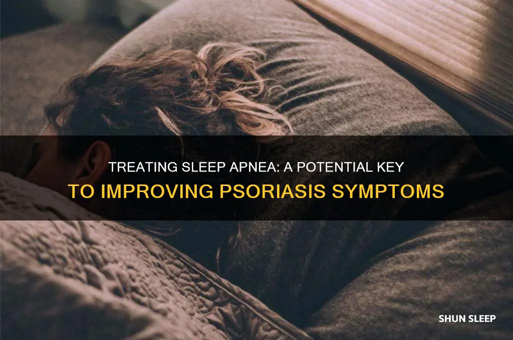 can treating sleep apnea help improve psoriasis