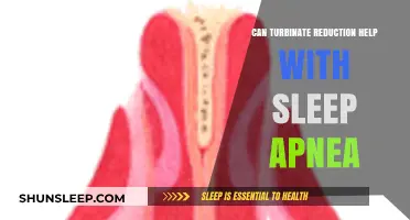Turbinate Reduction: A Potential Sleep Apnea Treatment Solution?