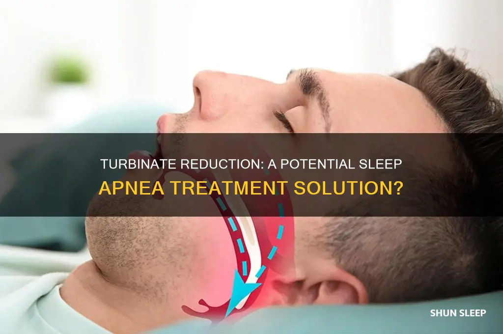 can turbinate reduction help with sleep apnea