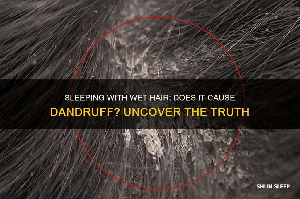 can u get dandruff from sleeping with wet hair