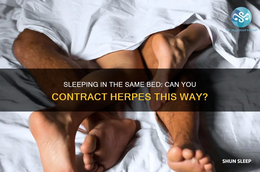 can u get herpes by sleeping in the same bed