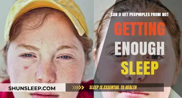 Lack of Sleep and Acne: Uncovering the Surprising Connection