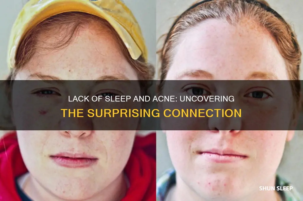 can u get peopmples from not getting enough sleep