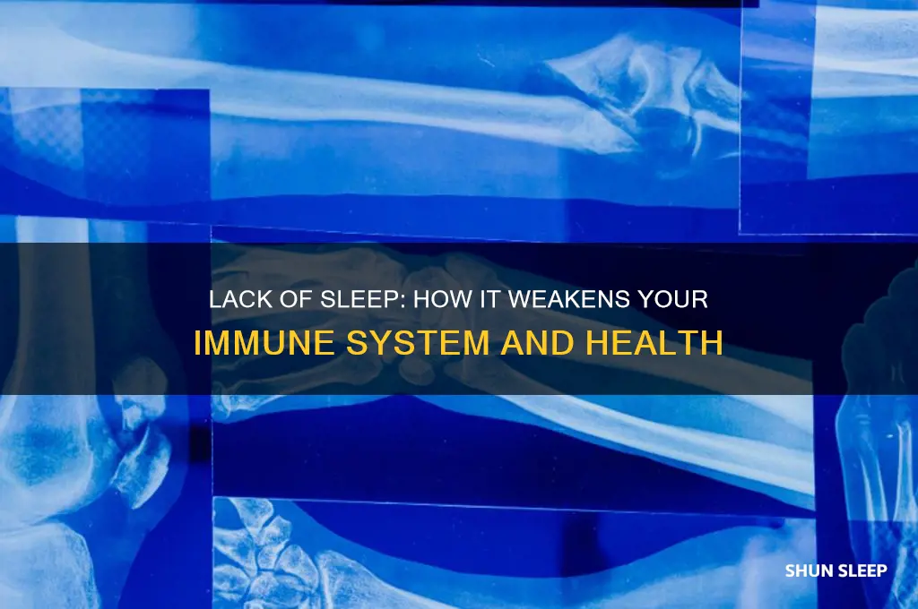 can u get sick from no sleep