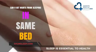 Can You Catch Warts from Sharing a Bed? Facts Revealed