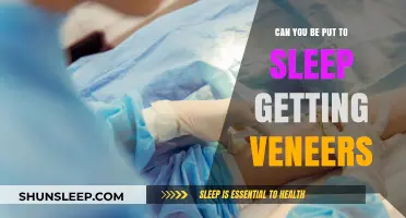 Can You Be Put to Sleep for Veneers? What to Expect