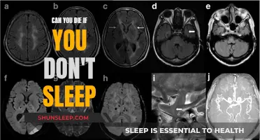 Sleep Deprivation: Deadly Effects of Staying Awake