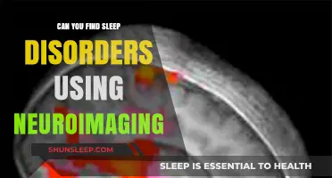 Neuroimaging: Uncovering Sleep Disorders