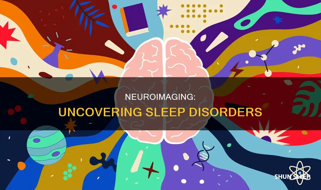 can you find sleep disorders using neuroimaging