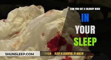 Waking Up with a Nosebleed: Causes and Prevention Tips