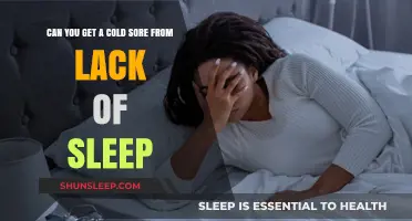 Lack of Sleep and Cold Sores: Unraveling the Surprising Connection